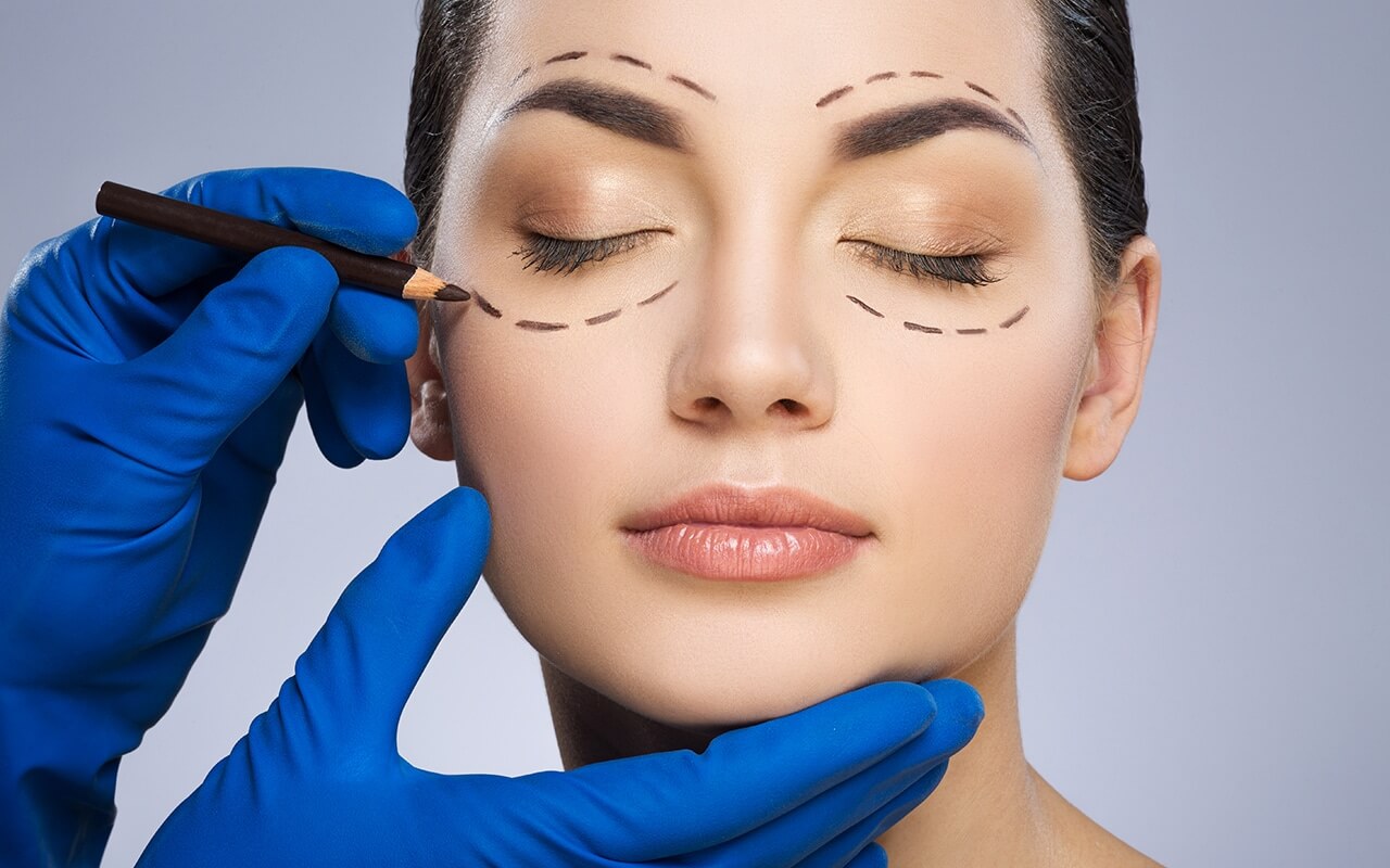 blepharoplasty