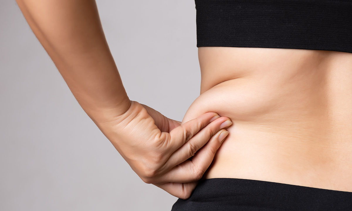 liposuction